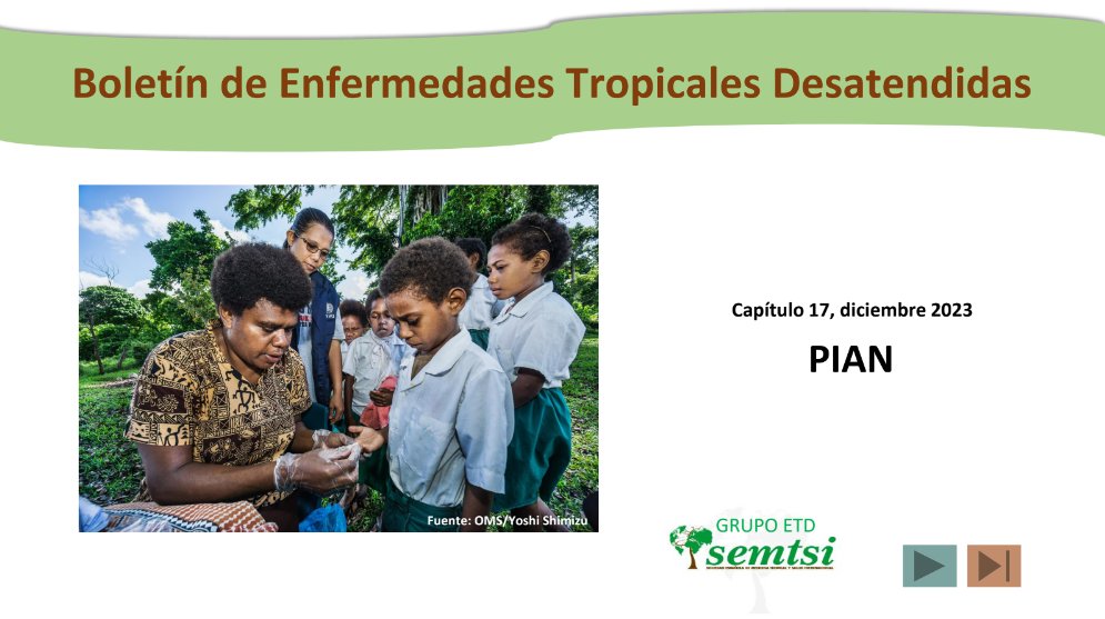 ¿Sabías que el pian es una de las tres enfermedades (junto a la poliomielitis y la dracunculosis) para las cuales la @WHO tiene como objetivo su erradicación? ¡No dudes en consultar más sobre esta #ETD en nuestro nuevo boletín! 🧪🧬💊🩻🎄@Semtsies drive.google.com/file/d/1v9KCSk…