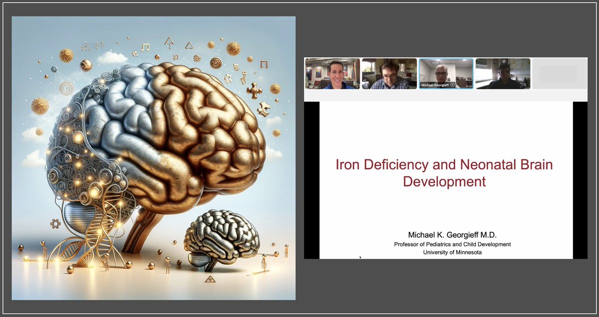 Dr. Michael Georgieff’s insights on iron as the unsung hero of neonatal neurodevelopment are groundbreaking. In the economy of health, iron is the currency of a golden brain. #IronEqualsGold 🧠💰