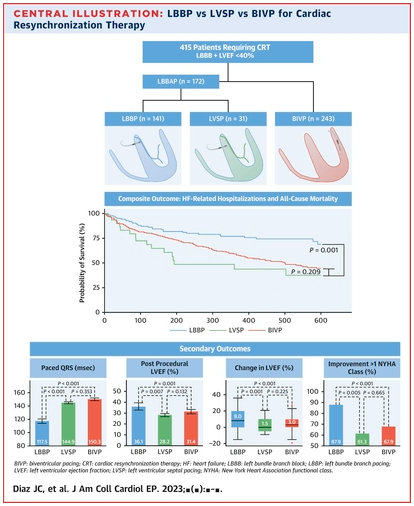 Outstanding paper from @jcdiaz1234 and @JorgeERomeroMD LV Septal Pacing near the LBB area (but not capturing LBB) had similar outcomes to BiV pacing. LBB pacing still had superior outcomes over LV septal and BiV pacing. @DrRoderickTung @MihailChelu jacc.org/doi/10.1016/j.…