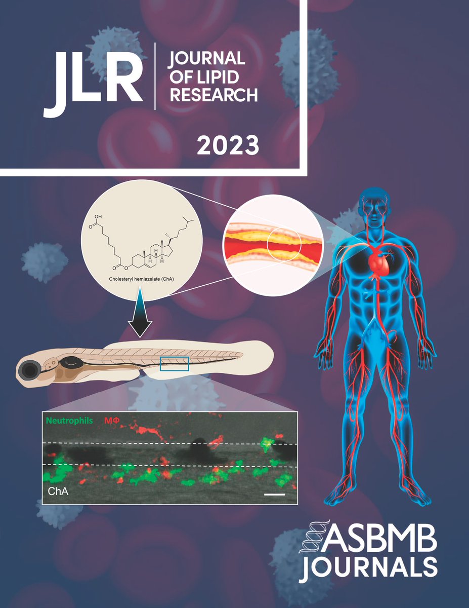 Multidisciplinary team, led by Otília Vieira @LysosomesL, identified a new molecule playing a key role in #cardiovasculardiseases🫀📰

Find out more in our latest Article at a Glance➡️ bit.ly/47bwSeC

Image credits: November cover @jlipidres
#NMSResearch #atherosclerosis