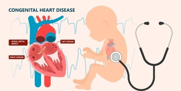 Now this one's not-so-popular #healthproblem. #CongenitalHeartDefects are structural abnormalities that occur at birth. Want to know more? 
Read here - manipaltrutest.com/blogs/explorin…
#CongenitalHeartDefects #HeartAwareness #CardiacHealth #HeartCare