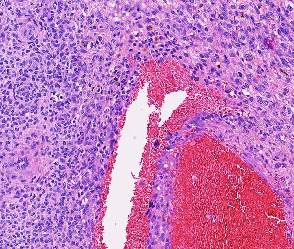 cygupath_md tweet picture