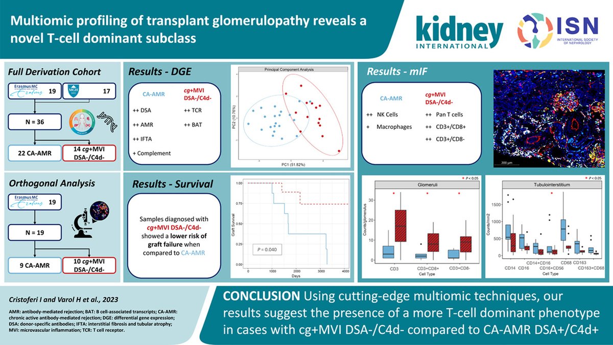 Multiomic profiling of #transplant #glomerulopathy reveals a novel T-cell dominant subclass doi.org/10.1016/j.kint… @RotterdamTrans @RWTH @UniklinikAachen @LUMC_Leiden @harvardmed @MGHPathology #OpenAccess #kidneytranplantation #kidneypath #PathTwitter #transcriptomics