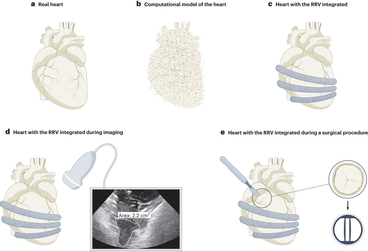 Thrilled to see the comments and highlights in the recent News &amp; Views article by Arianna Menciassi in <a href="/NatureCVR/">Nature Cardiovascular Research</a>  on our biohybrid platform simulating the right ventricle of the heart. nature.com/articles/s4416… <a href="/ellentroche/">Ellen Roche MIT</a>, <a href="/BonnemainJ/">Bonnemain Jean</a>, <a href="/cozturkphd/">Caglar Ozturk</a>, <a href="/BrianC_Ayers/">Brian Ayers, MD, MBA</a>