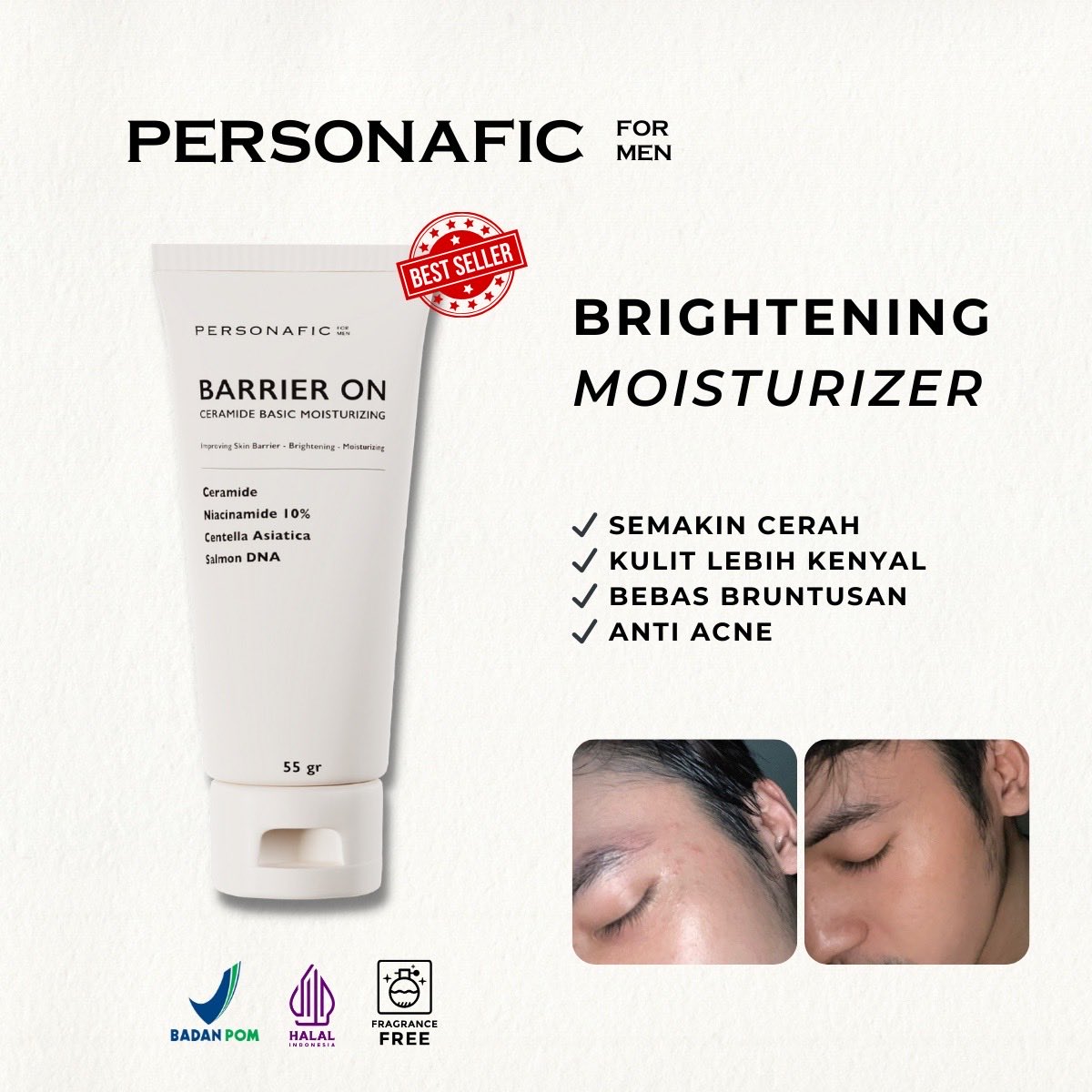 Kalau sering jerawatan atau skin barrier rusak, pilih moisturizer yang ada ceramide Bisa pakai punyanya Personafic, worth banget cuman sekitar 90an aja shope.ee/601jIr8FTl