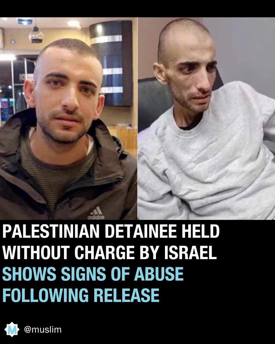 Palestinian detaînee held without charge by Israel shows signs of abuse following release. Farouq Khateeb from Ramallah was kidnapped 3 months ago and detained under administrative detention, without charge or trial.