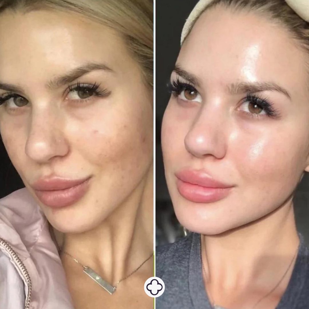 Meet our amazing new client <a href="/EmmeDiane/">Emme Diane</a>! 🤍 If you're looking for a solution to your "unsolvable" skin issues, Emme Diane is your answer. We are beyond excited for this partnership!
