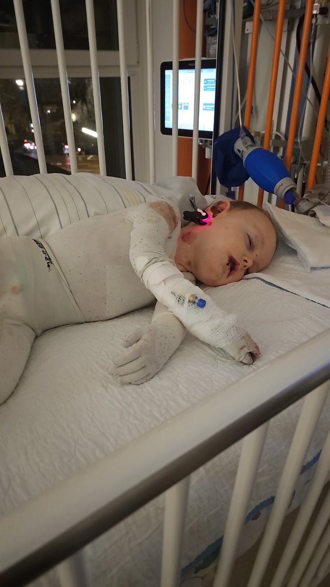 Viktor je danas operisan u Salcburgu, dilatacija jednjaka, koji je počeo da srasta, pa nije mogao da normalno guta ni pasirano. Na intezivnoj je nezi, sediran, jer je neminovno došlo do povreda usne duplje. Držite pesnice da se brzo oporavi, jer već 3. leti u SAD na terapiju 🙏❤️