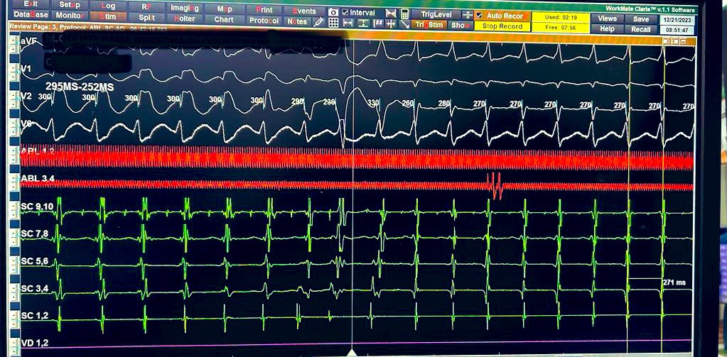 Pretty pretty… What is the mechanism? #EPfellows #EPeeps