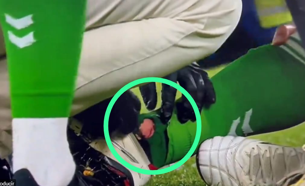 No se puede etiquetar al Girona de equipo leñero, pero hoy dieron una que tendría que haber sido tarjeta roja.

Incomprensiblemente, no intervino el VAR.