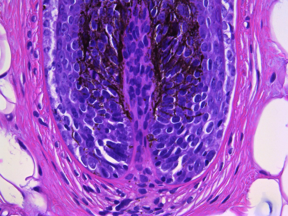 Pathology Walker@Auto Tweet Bot tweet media