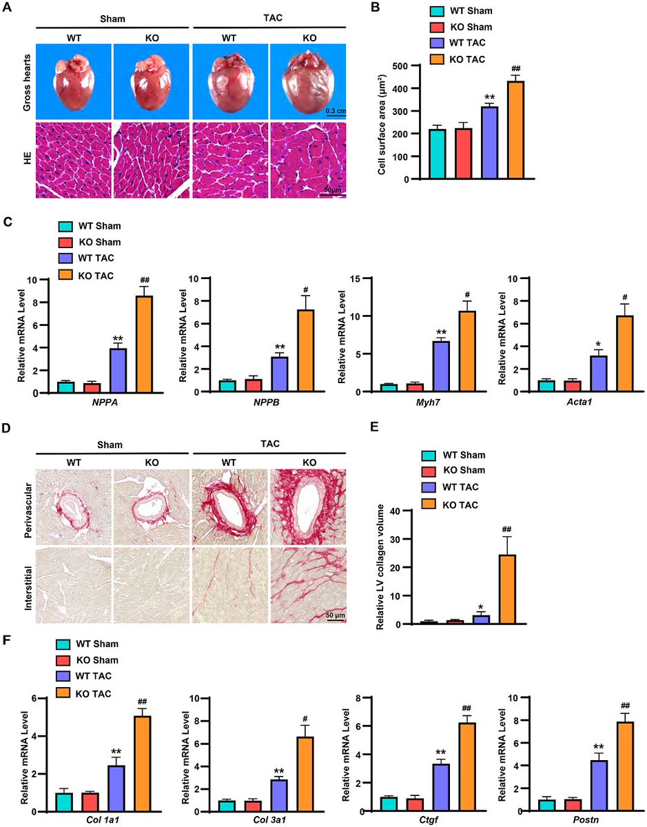 OTUD7B may be a key player in preventing cardiac hypertrophy by interacting with KLF4. This discovery opens doors for further in-depth research on OTUD7B's role in cardiac health and potential therapeutic applications. #AHAJournals ahajrnls.org/488Q8Lb