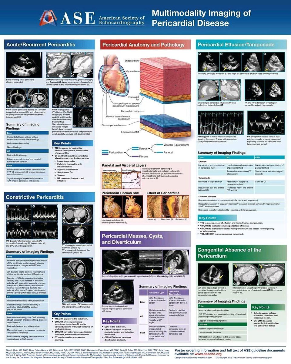 Multimodality Imaging of Pericardial Disease.
By American Society of Echocardiography.