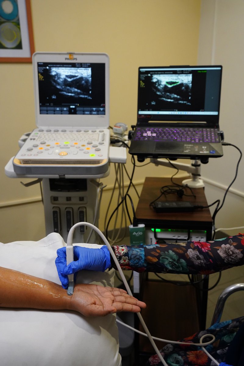 Researchers @cdsiisc and Aster CMI Hospital have developed an #AI tool that can screen ultrasound videos to track the median nerve, and help doctors diagnose carpal tunnel syndrome. iisc.ac.in/events/ai-tool… #IIScresearch