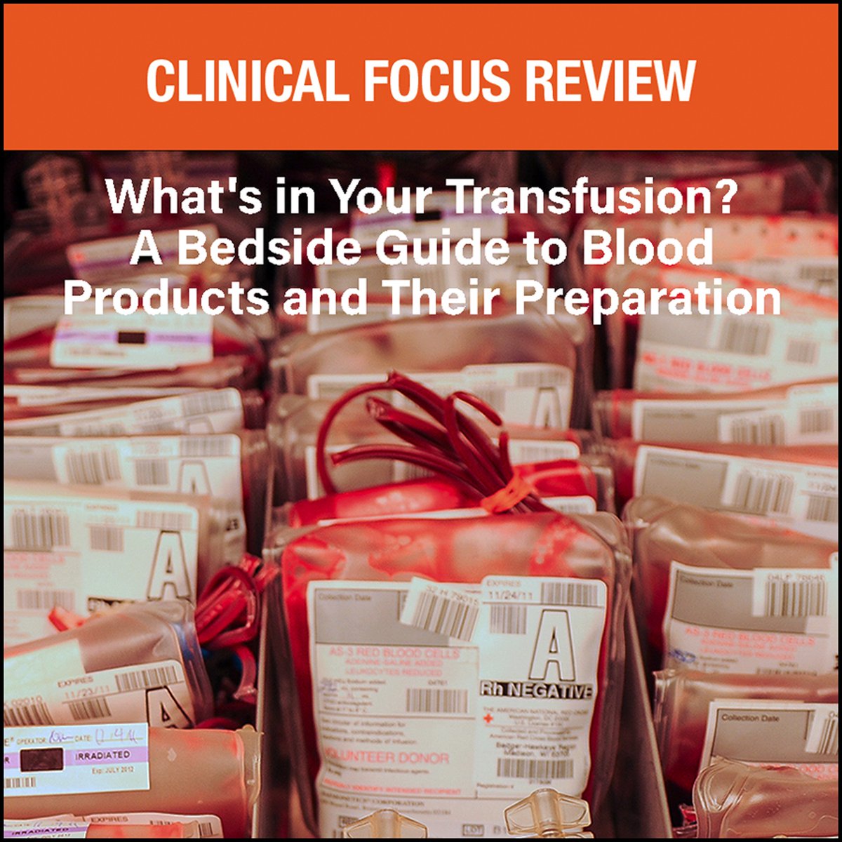 Understanding the contents of blood products and how they are modified before transfusion is key. In a new Clinical Focus Review, authors review five basic blood products and the five most common product modifications: ow.ly/G55r50Qlv0V