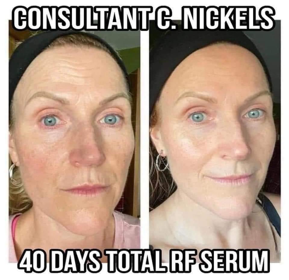 𝙈𝙪𝙨𝙩 𝙃𝙖𝙫𝙚 𝙋𝙧𝙤𝙙𝙪𝙘𝙩... ⭐️⭐️⭐️⭐️⭐️

TOTAL RF SERUM
✨Elasticity 
✨Even skin tone 
✨Fine lines 
✨Firmness
✨Hydration 
✨Plumpness 
✨Radiance
✨Reduced pores 
✨Revitalized skin
✨Skin texture 

Do you want a sample?!

#newyeargoals2024
#skincaresamples