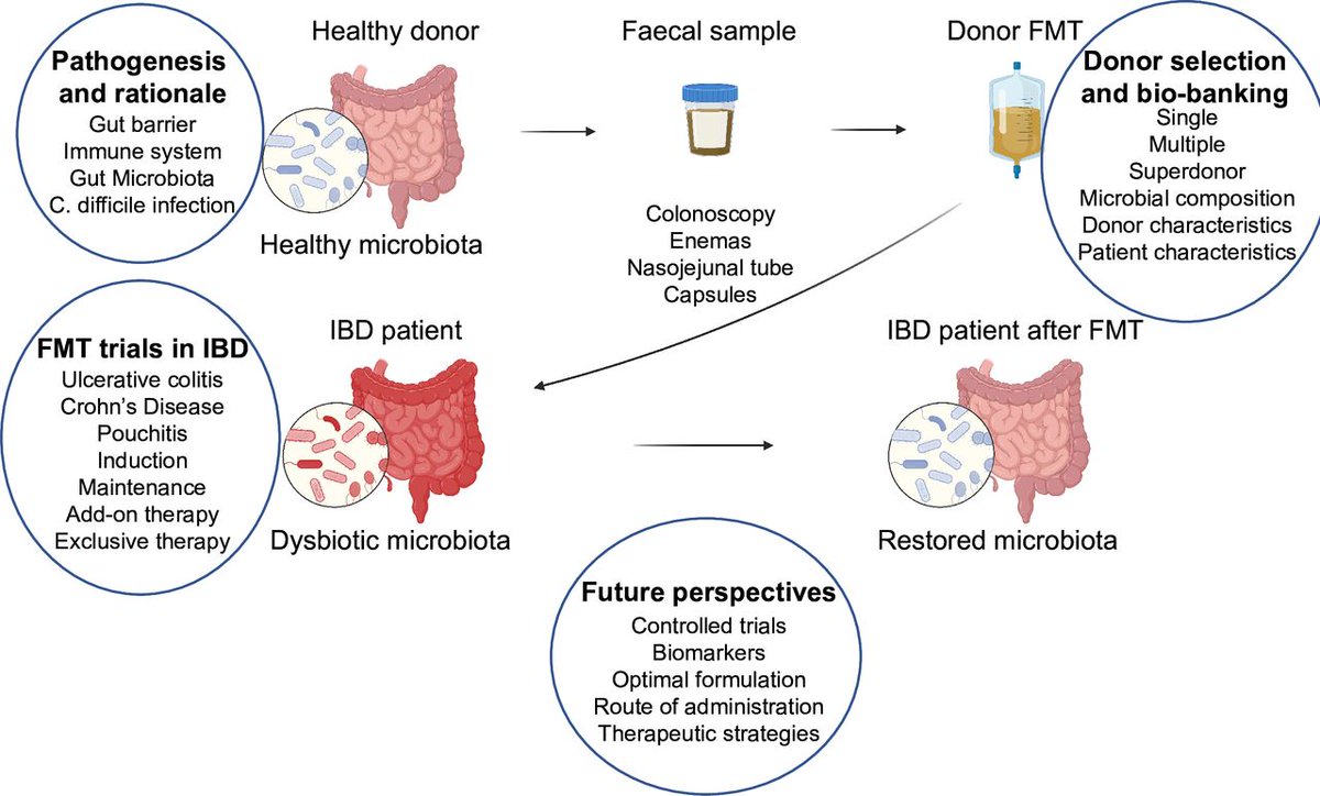 The 9th #TopGUTPaper2023 from #Sept2023 is by @LRLopetuso et al on “The first international Rome consensus conference on gut microbiota and FMT in IBD” via bit.ly/48b0AlC Podcast: bit.ly/44ziJH1 @DeleuSara @LGodny @h_sokol @gianluca1aniro @GiovanniCammar9