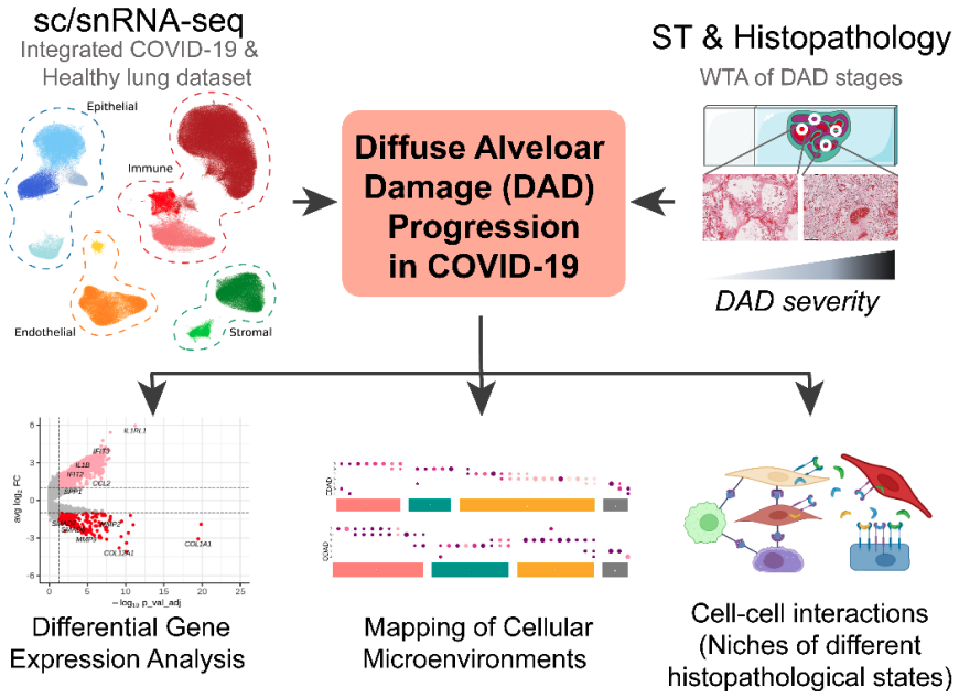 #Spatial Preprint🚨We've integrated #Histopathology, Spatial & #Singlecell #Transcriptomics to unravel #COVID19 🫁damage complexities. Joint effort with @bayraktar_lab @sangerinstitute @NosedaLab @imperialcollege @m_hemberg @UKCICstudy collabs. Check out 🧵doi.org/10.1101/2023.1…