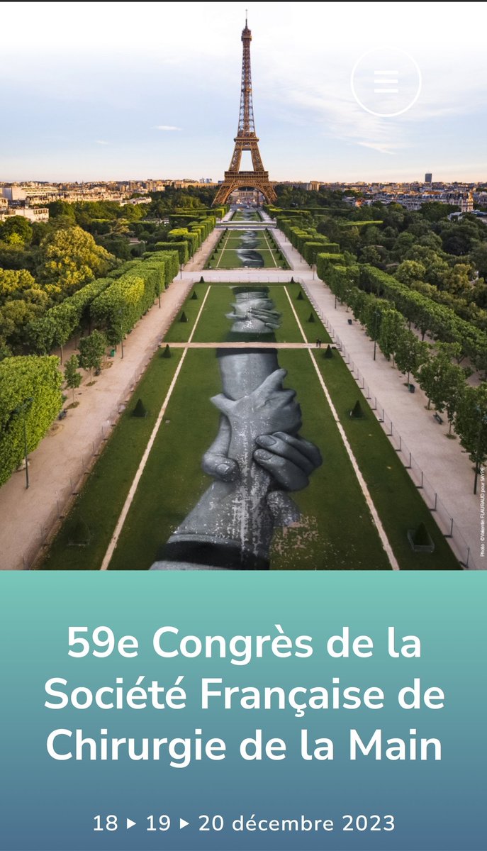 Ravi d'avoir présenté mon bilan de mobilité scientifique au Luxembourg lors du Congrès de la Société Française de Chirurgie de la Main à Paris. Merci à @CHUnantes @MPRLocoNantes @SFCM_France et Institut Européen de la Main d'avoir rendu cela possible !