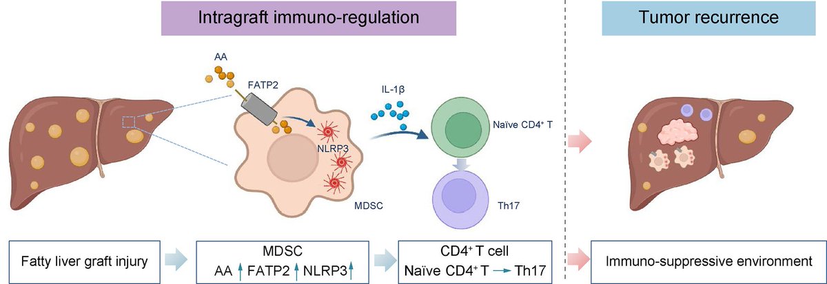 Arachidonic acid activates NLRP3 inflammasome in MDSCs via FATP2 to promote post-transplant tumour recurrence in steatotic liver grafts 🔓#OpenAccess at 👉 jhep-reports.eu/article/S2589-… #LiverTwitter