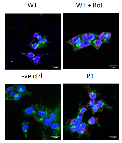 Prostate Cell News (@prostatecell) on Twitter photo 📘 New in <a href="/MolOncology/">Molecular Oncology</a>!
<a href="/ChloeGulliver/">Chloé Gulliver</a> at the <a href="/baillie_lab/">Baillie Lab</a> & colleagues report the existence of a newly identified PDE4D7–DHX9 signaling complex that may be crucial in #ProstateCancer pathogenesis.
Learn more in the full study:
🔗 bit.ly/4ayg4Bq 📘 New in <a href="/MolOncology/">Molecular Oncology</a>!
<a href="/ChloeGulliver/">Chloé Gulliver</a> at the <a href="/baillie_lab/">Baillie Lab</a> & colleagues report the existence of a newly identified PDE4D7–DHX9 signaling complex that may be crucial in #ProstateCancer pathogenesis.
Learn more in the full study:
🔗 bit.ly/4ayg4Bq