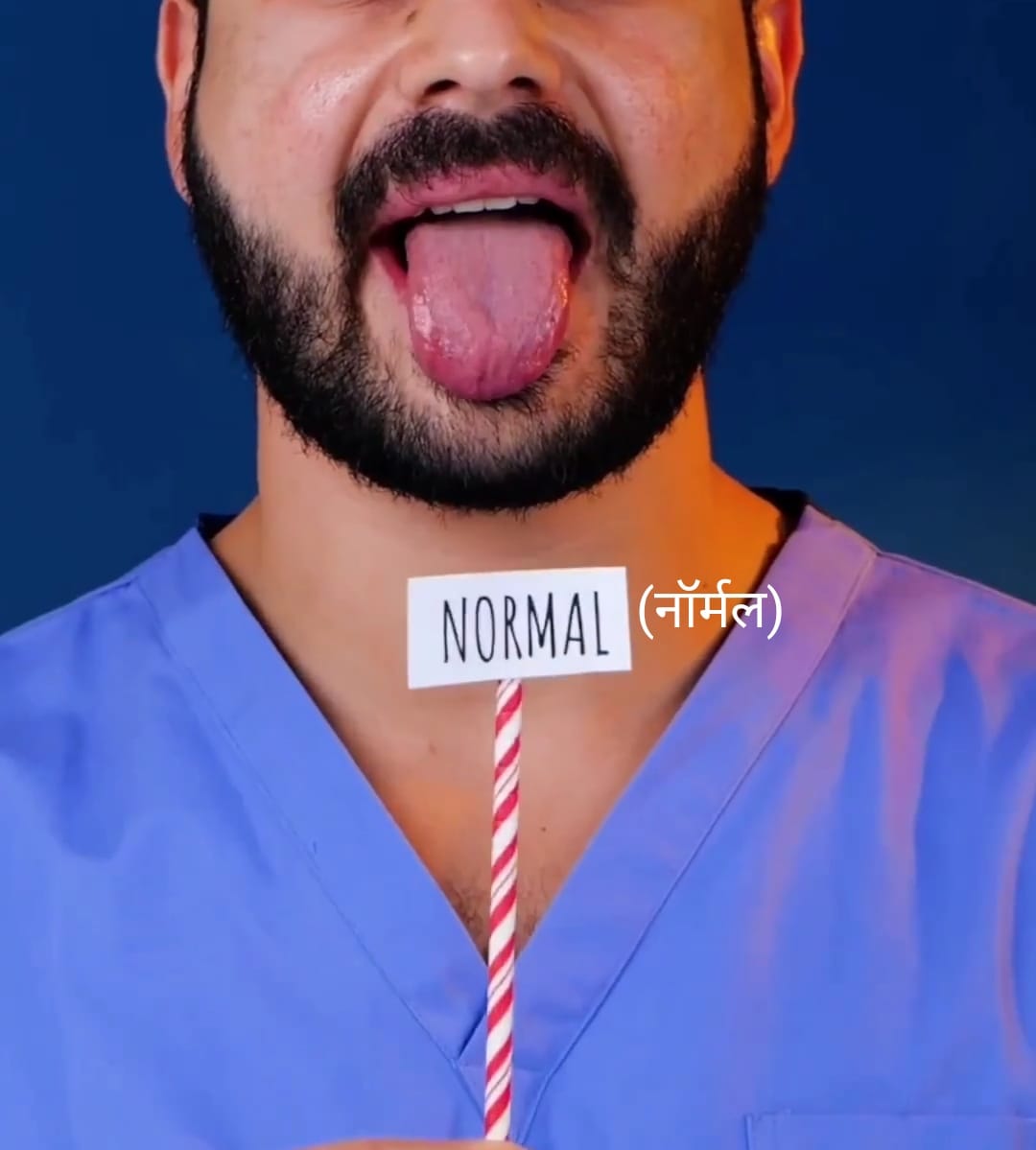 🔵What your tongue says about your health.

🔵जीभ देखकर जानिए अपनी सेहत और बीमारियां ..

विभिन्न बीमारियों में हमारे जीभ का कलर/रंग बदल जाता है अगर हम इसे ध्यान से देखें और पहचानना सीख जाए तो कोई बीमारियों का पता समय रहते हैं चल जायेगा I 👇👇
 #HealthTips #healthylifestyle