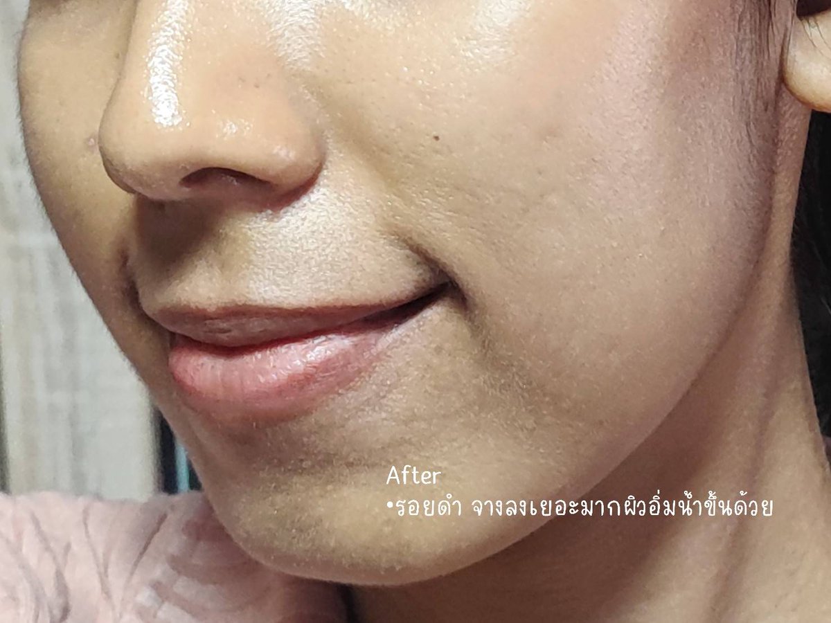 ♡ᔕ ทำไมเขาเรียกฉันว่า ชะนี ᔕ ♡ tweet media