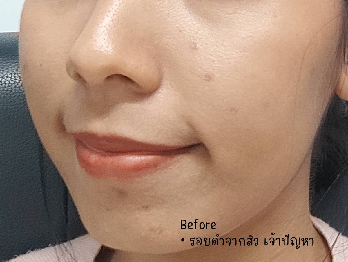 ♡ᔕ ทำไมเขาเรียกฉันว่า ชะนี ᔕ ♡ tweet media