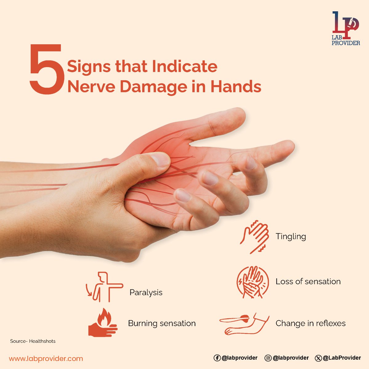 Hands and arms may occasionally develop numbness or pain as a result of damage to nerves. Identifying the underlying reason is critical for evaluating whether physiotherapy or other treatment is required. 

#nervedamage #nervepain #nerves #handnumbness #nerveinjury  #labprovider