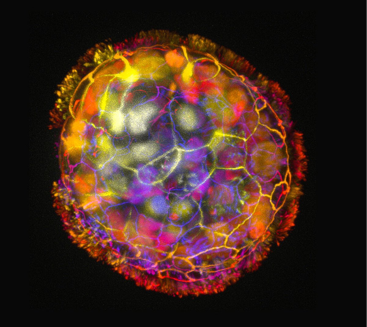 talius's tweet image. #Anthrobots: Scientists Build #Tiny #Biological #Robots from #Human #Tracheal #Cells
Researchers have created tiny Anthrobots from human tracheal cells that can move across a surface and encourage #neuron #growth across a region of damage in a lab dish... scitechupdates.com/anthrobots-sci…