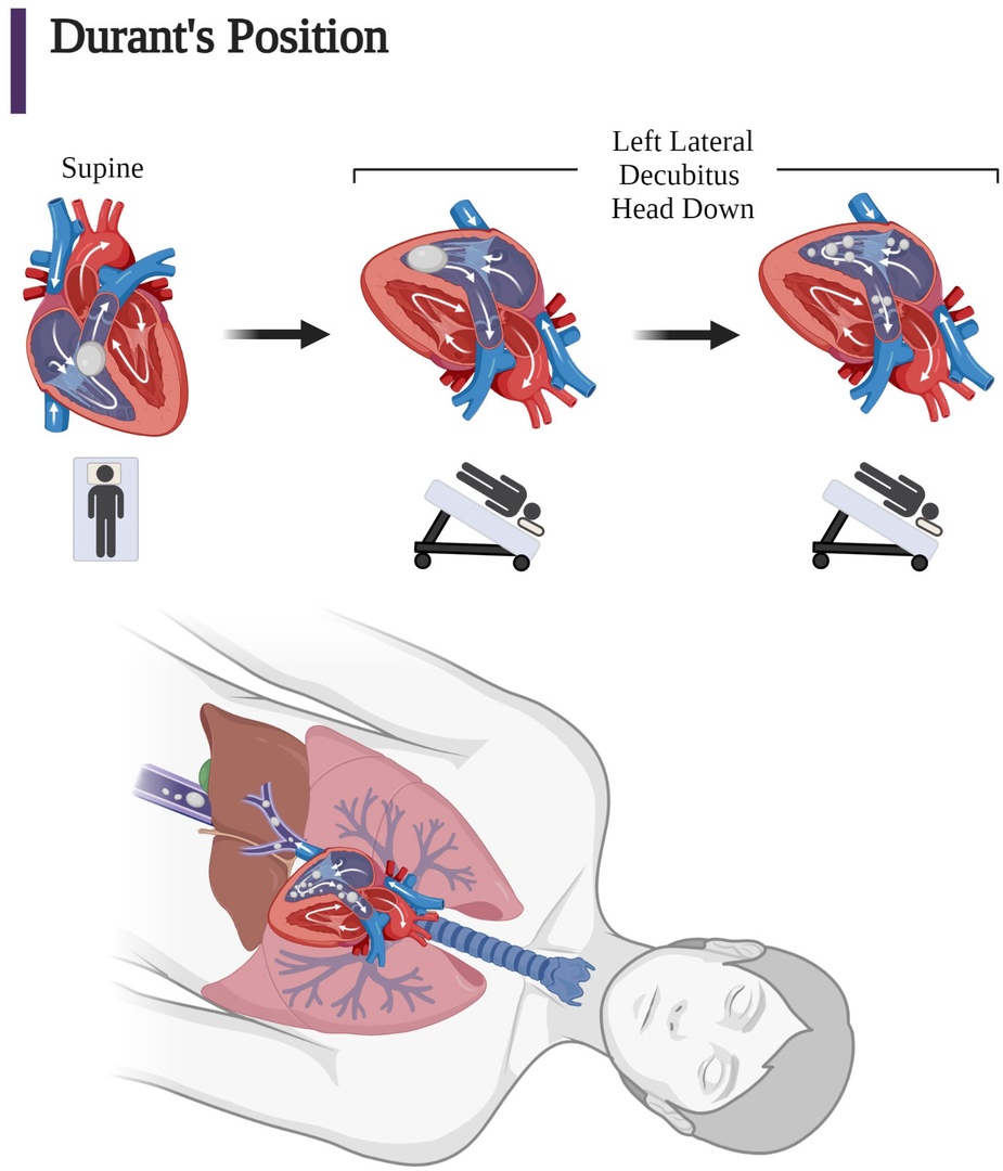 Today's paper of the day is on iatrogenic air embolism: pathoanatomy, thromboinflammation, endotheliopathy, and therapies
criticalcarereviews.com/latest-evidenc…

Join us to read 1 paper per day and stay up-to-date as we cover the spectrum of critical care across 2023