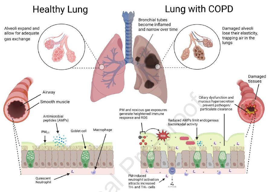 Pathological changes in COPD increase susceptibility to negative health effects of air pollution exposure @accpchest doi.org/10.1016/j.ches…