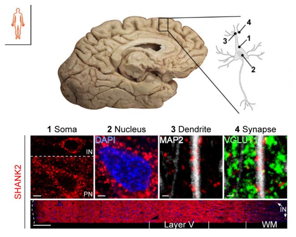 📣SHANK2 and SHANK3 expression study in the central nervous system
🚨This is the so far most comprehensive study comparing SHANK2 and SHANK3 expression between human and rodent brains.
Great work by Dr. Schön &amp; Dr. Wölfle!
Check our new paper click here👇
bmcbiol.biomedcentral.com/articles/10.11…