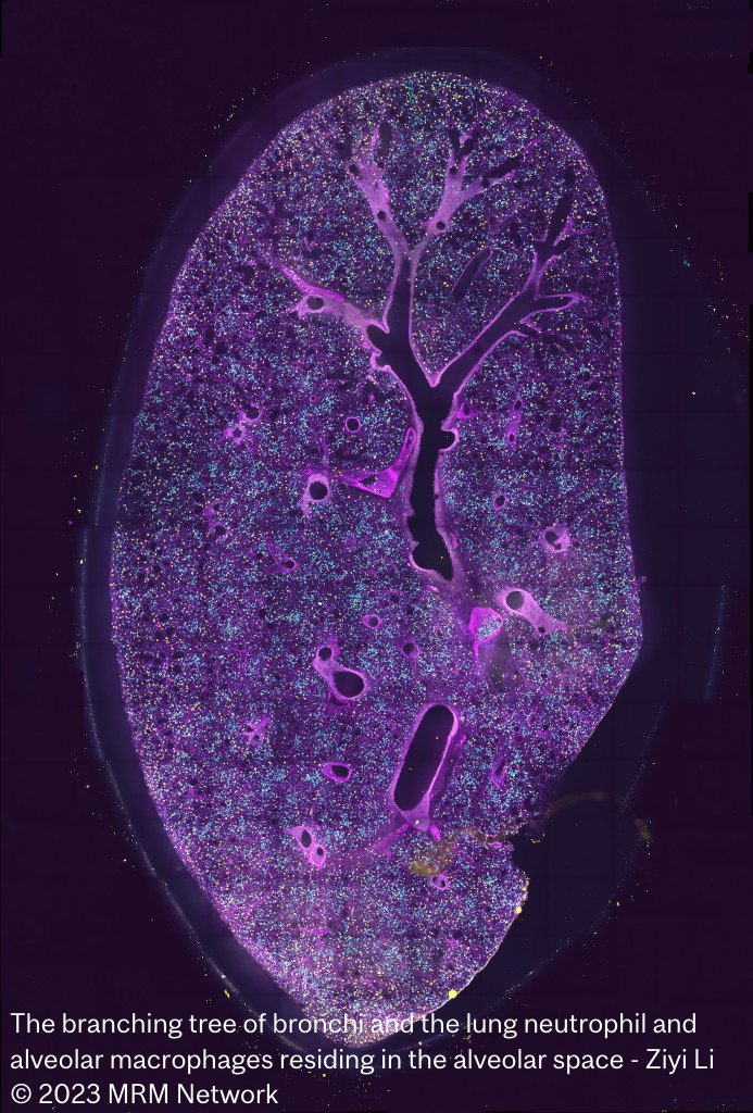 Congratulations to  Neha Dinesh (<a href="/DineshNeha2/">Dinesh, Neha</a>,  Reihnardt Lab, <a href="/McGill_ACB/">Anatomy&CellBiology</a>) and Ziyi Li (<a href="/AjithaT4/">Ajitha Thanabalasuriar</a> Thanabalasuriar Lab, Dpt of Pharmacology &amp; Therapeutics) who respectively won 1st &amp; 2nd prizes in the 2023 #MRM_Photo_Contest! See all entries here: mrm.research.mcgill.ca/about-us/mrm-p…