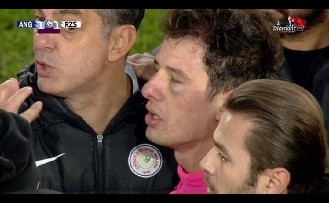 Yapılan bu saldırıyı hiç bir insan hak etmez . Sonuç ne olursa olsun ne kadar yanlış kararlar verilirse verilsin . Yazıklar olsun türk futbolundan kirli ellerinizi çekin #HalilUmutMeral . Geçmiş olsun . Futbolun sadece bir oyun olduğunu unutmayın .