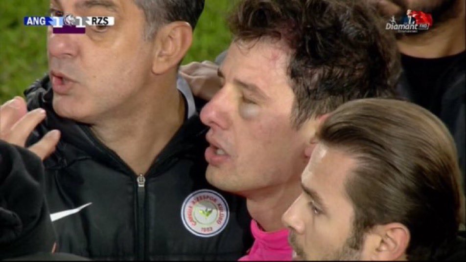 Dün Josef bugün Halil Umut Meler iki olay aynı sahada aynı kulüp tarafından yapıldı ve bu iki olayın en büyük sorumlusu zamanında gerekli cezayı vermeyen Türkiye futbol Federasyonudur
 Ve her  #atılanyumruktff'yedir