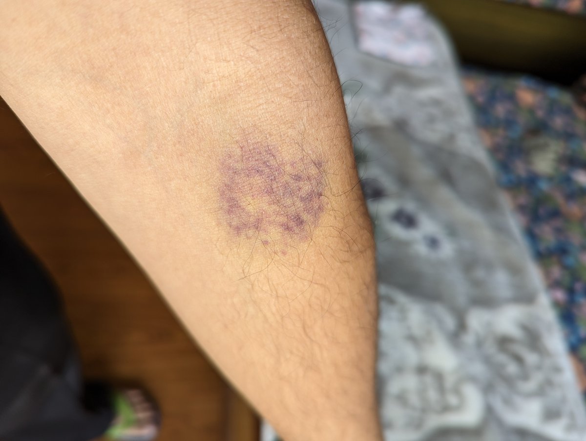 Prashant Kumar Singh tweet media