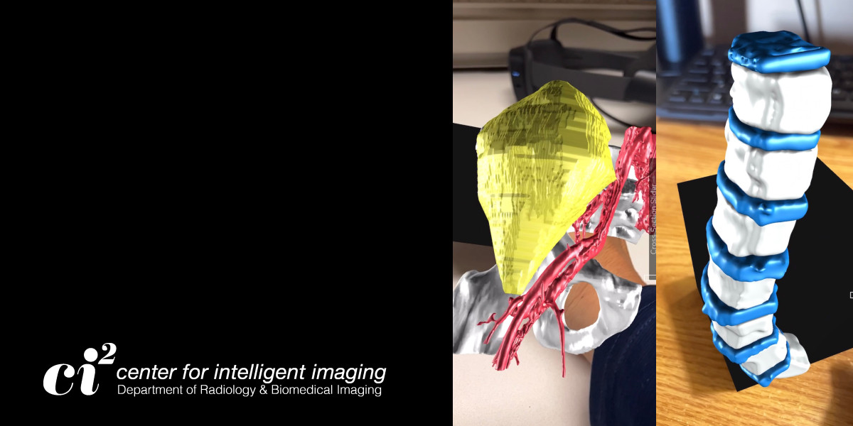 New blog post: The Impact of Transformational Technologies in Radiology ➡️ intelligentimaging.ucsf.edu/news/impact-tr…