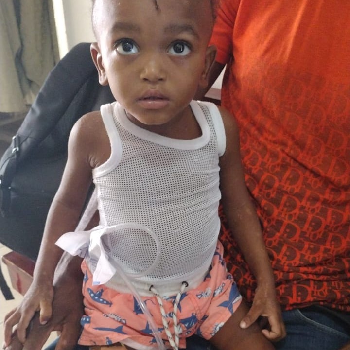 Two-year-old Woodson (Haiti) was born with multiple congenital bladder and genital malformations. He has now undergone multiple surgeries, thanks to the devoted care of Haiti urologist Dr. Charles Denis, and is well on the road to recovery. Read more at tinyurl.com/2762hjsu.