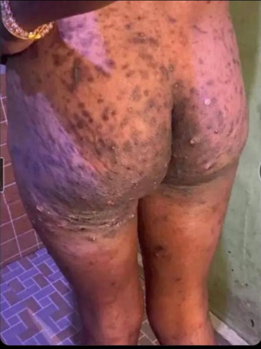 Blackea53363867's tweet image. Unaona hizi pacho cha Christmas aje😂💔