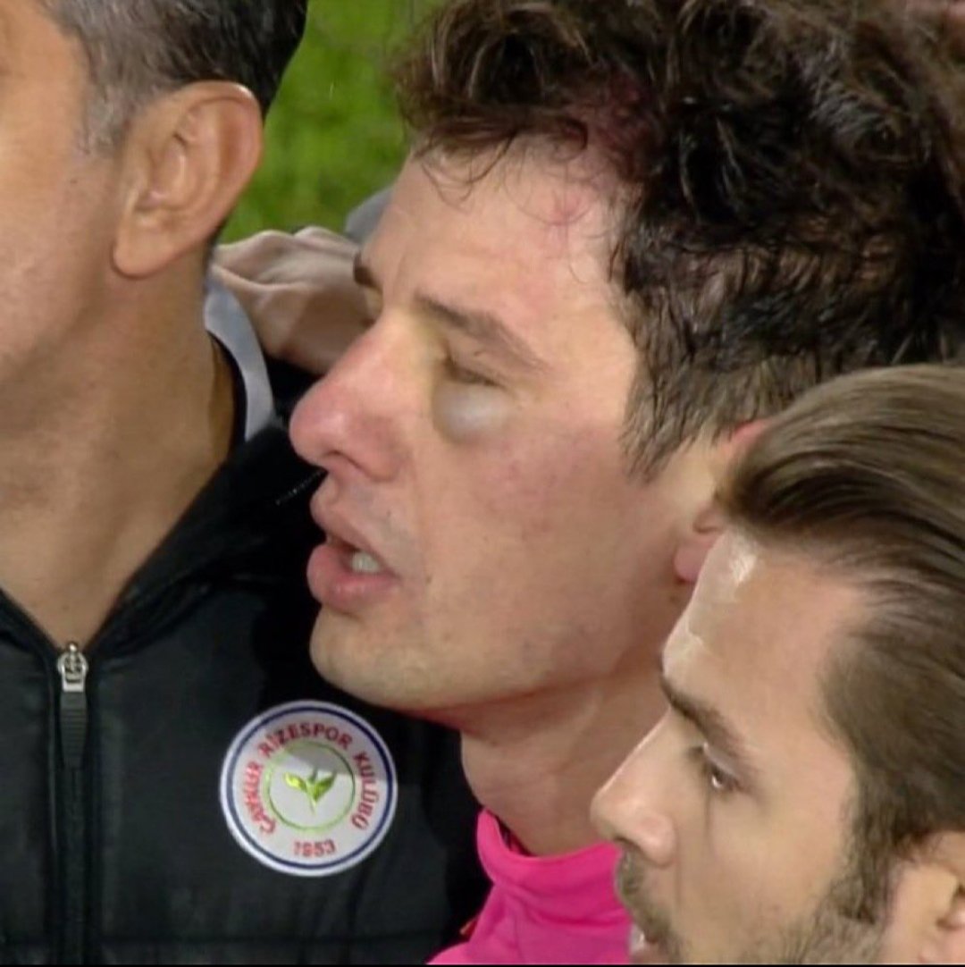 Bunu konu kapatılmamalı, üzerine gidilmeli,
Zira Hakemlerin DOKUNULMAZ olmadığı gerçeği ortaya çıktı,  Belli aralıklarla hakemlere dokunulmaz olmadıkları kulüp başkanları tarafından hatırlatımalı. 
#FarukKoca <a href="/kulupler/">Kulüpler Birliği</a>