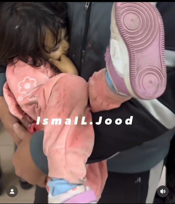 أجيج (@1b2_r) on Twitter photo <a href="/jacksonhinklle/">Jackson Hinkle 🇺🇸</a> Did you see the video of this little Palestinian girl? This is a screenshot of her father rushing her into a barely functioning hospital. He’s carrying her like that to try to keep her intestines from spilling out. She was disemboweled by an Israeli missile.
Did you see the <a href="/jacksonhinklle/">Jackson Hinkle 🇺🇸</a> Did you see the video of this little Palestinian girl? This is a screenshot of her father rushing her into a barely functioning hospital. He’s carrying her like that to try to keep her intestines from spilling out. She was disemboweled by an Israeli missile.
Did you see the