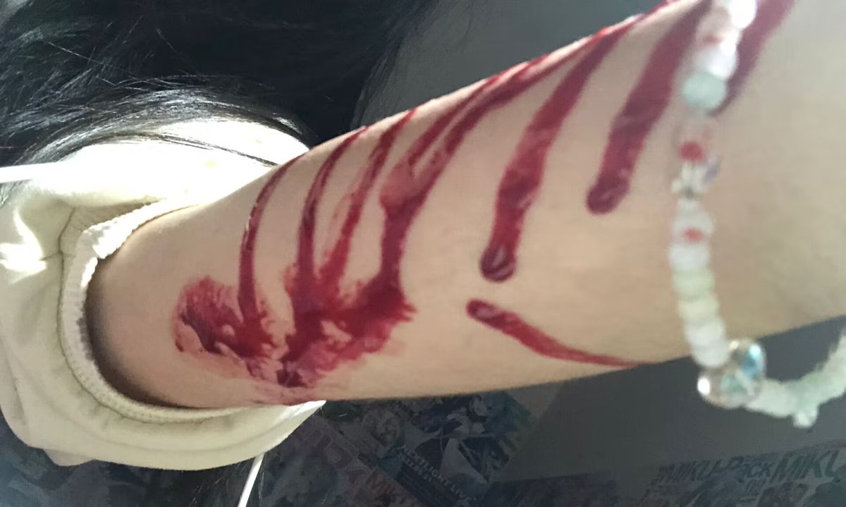 sakura_killme's tweet photo. #自伤 #自残 #凉席印 好舒服 https://t.co/SwXvnDjS4e