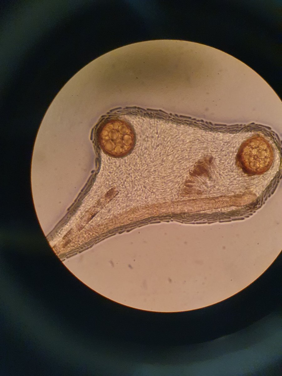 NJHochenegger's tweet photo. Hello dearest 🍄-People!
Upon examining fungal isolates from environmental samples I stumbled across this funny epiphyte: 
These pictures show the growth on PDA for nine days and the microscopic structures using 1000x magnification. Do you have any idea what we have/see here? https://t.co/sNdItVugDp