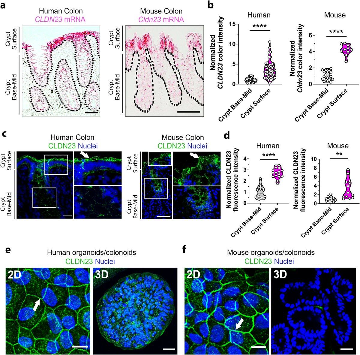 Read the latest #SMIMemberPaper by Parkos &amp; Nusrat Lab <a href="/Parkos_Nusrat/">Parkos&Nusrat_Lab</a> in <a href="/NatureComms/">Nature Communications</a> on intestinal tight junction control by Claudin-23. nature.com/articles/s4146…