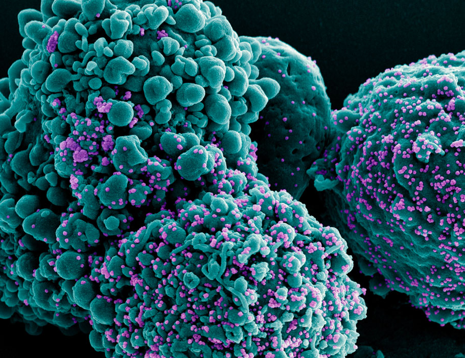 Science Magazine (@sciencemagazine) on Twitter photo Although patients with #Bcell deficiencies lack antibodies, a new clinical study shows that #mRNA vaccines can still reduce the risk of severe #COVID19 in these individuals, including those treated with #rituximab, by enhancing T cell immunity. <a href="/ScienceTM/">Science Translational Medicine</a> scim.ag/5a5 Although patients with #Bcell deficiencies lack antibodies, a new clinical study shows that #mRNA vaccines can still reduce the risk of severe #COVID19 in these individuals, including those treated with #rituximab, by enhancing T cell immunity. <a href="/ScienceTM/">Science Translational Medicine</a> scim.ag/5a5
