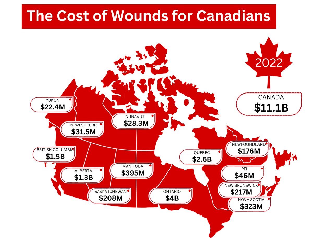 The Costs of Wounds in Canada: The International Wound Journal recently published an editorial showing what Canadians could be spending on managing wounds, both nationally and provincially. #wound #costs #IWJ #Canada #WoundsCanada onlinelibrary.wiley.com/doi/epdf/10.11…