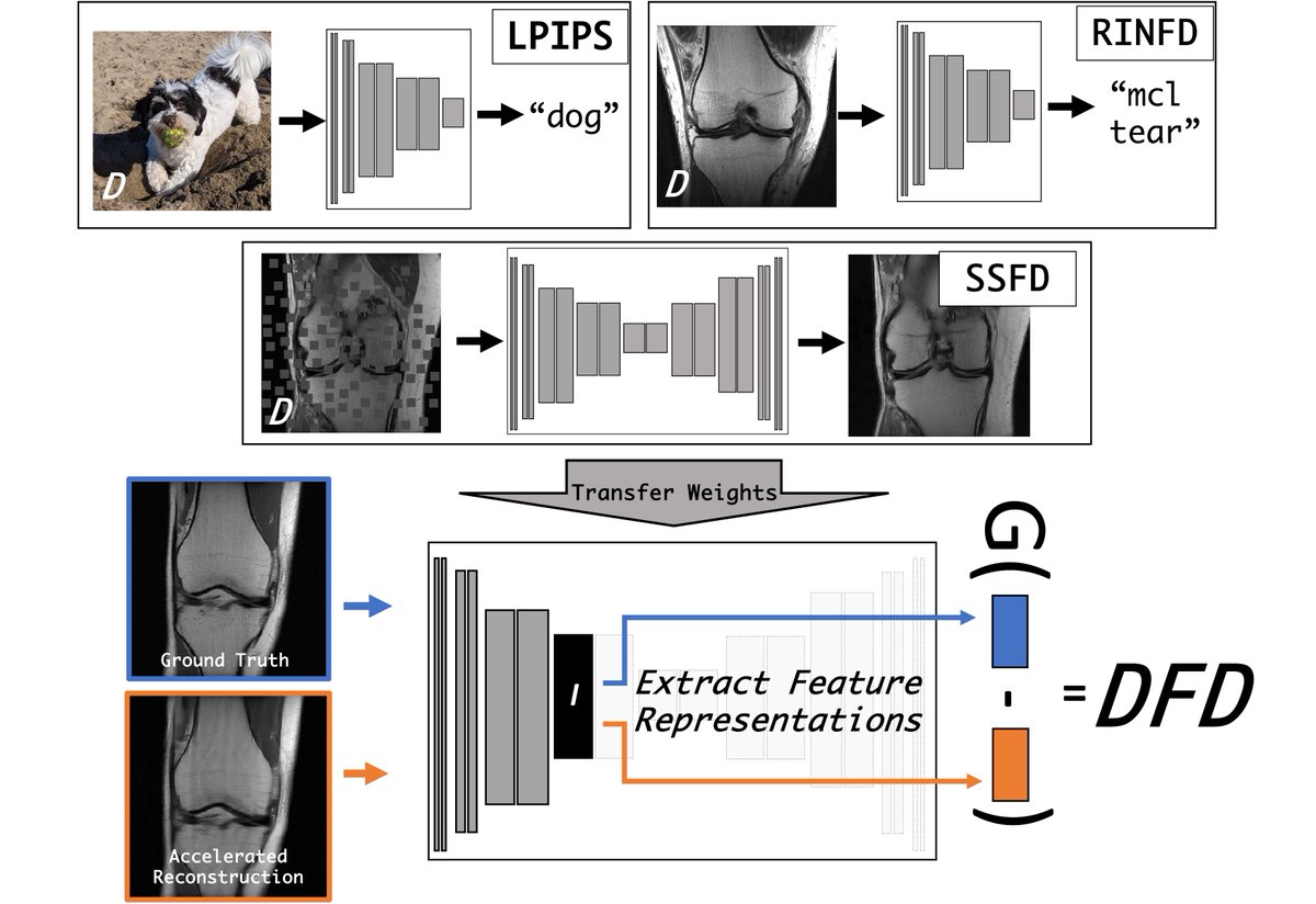 Excited to present at the #NeurIPS2023 Deep Inverse Workshop this week on 'Using Deep Feature Distances (DFDs) for Evaluating MR Image Reconstruction Quality.' We compare DFDs to traditional image quality (IQ) metrics in terms of correlations to radiologist-perceived IQ.🧵1/6