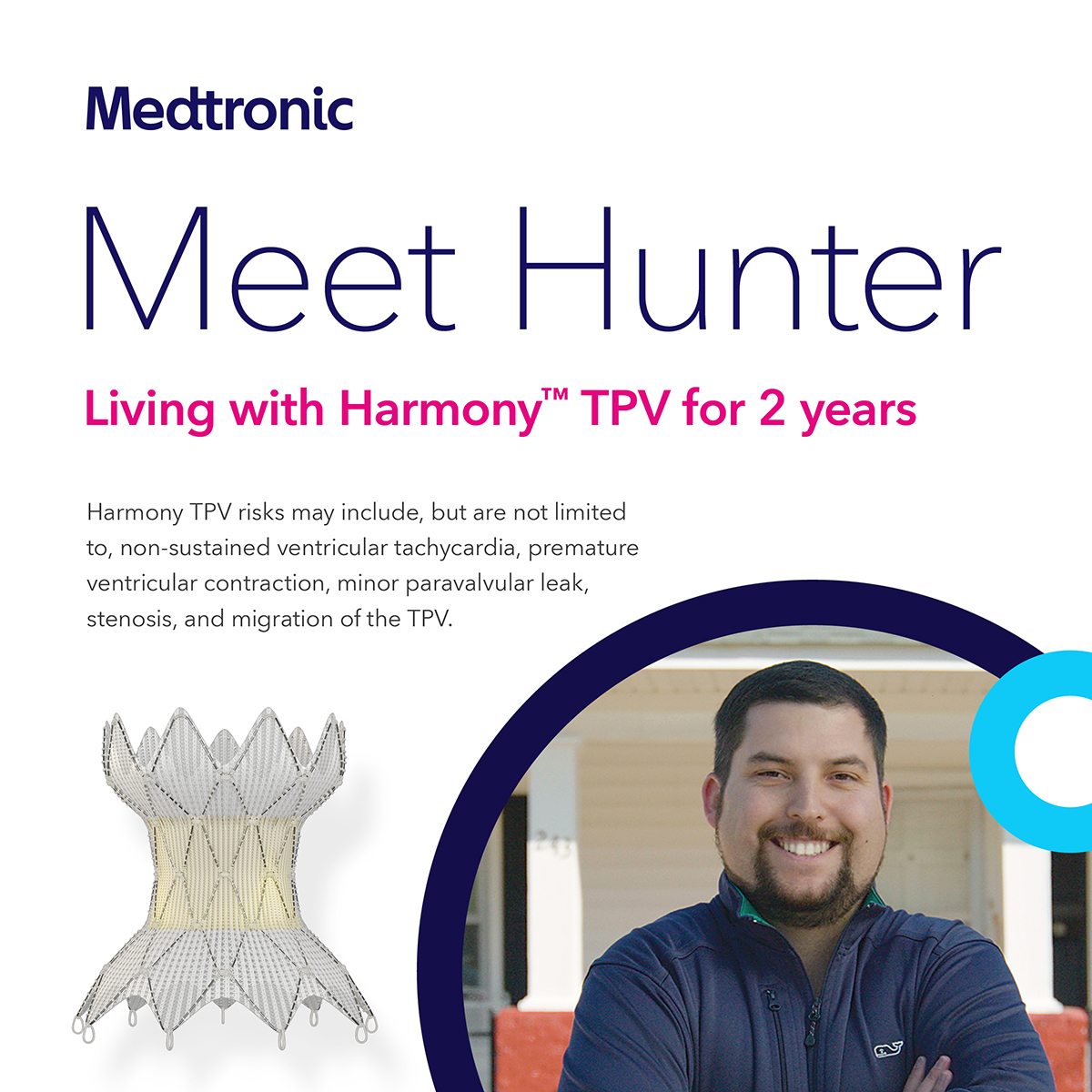 Hear first-hand from Hunter, born with tetralogy of Fallot, about living with Harmony™ TPV for the last 2 years — and how he lives his life to the fullest. See risk info bit.ly/3RbOXU4 Learn more: bit.ly/3RFgS0f #chd #HarmonyTPV1000