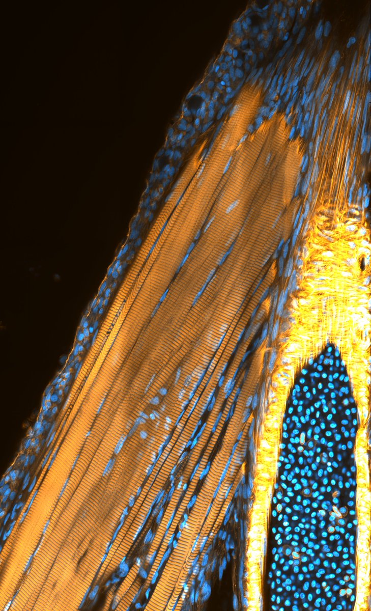 Cod gills - Adductor muscles. Fish can 'cough' by contracting skeletal muscle fibers associated to gill filaments. To the left is a mucosal epithelium, adductor muscle fibers to the middle, and afferent artery to the right. Actin is orange and nuclei in blue.